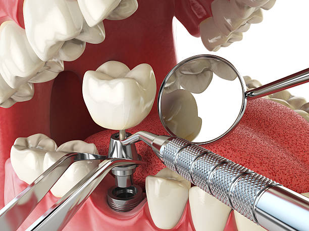 Best Emergency Treatment for Jaw Pain or Injury in Three Points, AZ